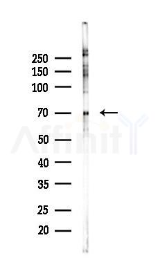 HDAC10 Recombinant Rabbit mAb - Western blot analysis of lysates from PC12 cells(UV 30min treatment), using HDAC10 Recombinant Rabbit mAb at 1/1000 dilution.