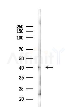 GDF3 Recombinant Rabbit mAb - Western blot analysis of lysates from Mouse kidney, using GDF3 Recombinant Rabbit mAb at 1/1000 dilution.