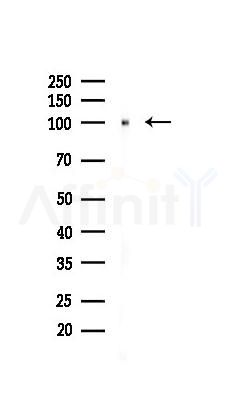 eEF2K Recombinant Rabbit mAb - Western blot analysis of lysates from PC12 cells(UV 30min treatment), using eEF2K Recombinant Rabbit mAb at 1/1000 dilution.