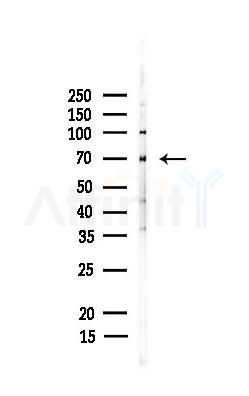 K2C1 Recombinant Rabbit mAb - Western blot analysis of lysates from PC12 cells(UV 30min treatment), using K2C1 Recombinant Rabbit mAb at 1/1000 dilution.