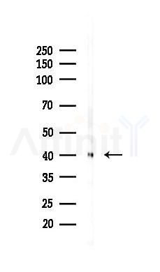 MKK3/MKK6 Recombinant Rabbit mAb - Western blot analysis of lysates from PC12 cells(UV 30min treatment), using MKK3/MKK6 Recombinant Rabbit mAb at 1/1000 dilution.