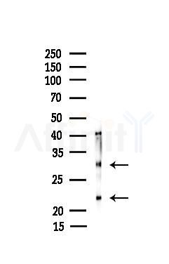 MOG Recombinant Rabbit mAb - Western blot analysis of lysates from PC12 cells(UV 30min treatment), using MOG Recombinant Rabbit mAb at 1/1000 dilution.