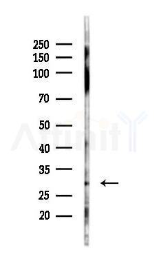 Prohibitin Recombinant Rabbit mAb - Western blot analysis of lysates from PC12 cells(UV 30min treatment), using Prohibitin Recombinant Rabbit mAb at 1/1000 dilution.