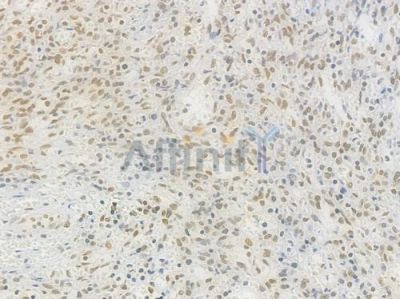 RAD50 Recombinant Rabbit mAb - BF4568 at 1/100 staining Human spleen tissue by IHC-P.