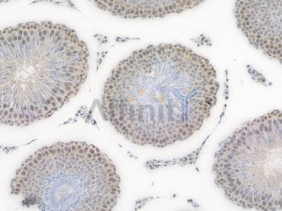 RAD50 Recombinant Rabbit mAb - BF4568 at 1/100 staining Rat testicular tissue by IHC-P.