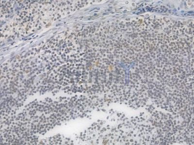 RAD50 Recombinant Rabbit mAb - BF4568 at 1/100 staining Human tonsil tissue by IHC-P.