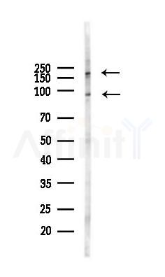 MUC13 Recombinant Rabbit mAb - Western blot analysis of lysates from HUVEC cells(starvation 24h treatment), using MUC13 Recombinant Rabbit mAb at 1/1000 dilution.