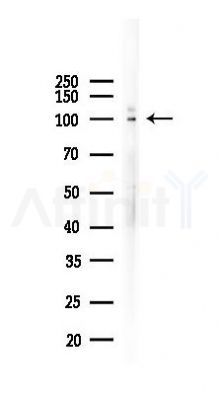 CD105 Recombinant Rabbit mAb - Western blot analysis of lysates from B16F10-LUC cells(heat-shock 45min treatment), using CD105 Recombinant Rabbit mAb at 1/1000 dilution.