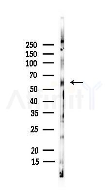 EFEMP2 Recombinant Rabbit mAb - Western blot analysis of lysates from PC12 cells(UV 30min treatment), using EFEMP2 Recombinant Rabbit mAb at 1/1000 dilution.