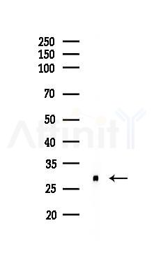 Carbonic Anhydrase 1/CA1 Recombinant Rabbit mAb - Western blot analysis of lysates from Mouse heart, using Carbonic Anhydrase 1/CA1 Recombinant Rabbit mAb at 1/1000 dilution.