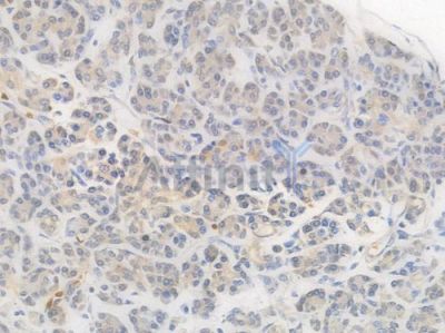 Carbonic Anhydrase 1/CA1 Recombinant Rabbit mAb - BF4579 at 1/100 staining Human pancreatic tissue by IHC-P.