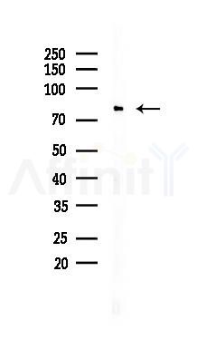 Ezrin Recombinant Rabbit mAb - Western blot analysis of lysates from HUVEC cells(UV 30min treatment), using Ezrin Recombinant Rabbit mAb at 1/1000 dilution.