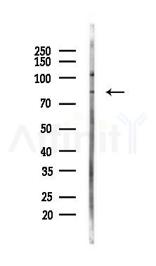 Quiescin Q6 Recombinant Rabbit mAb - Western blot analysis of lysates from PC12 cells(UV 30min treatment), using Quiescin Q6 Recombinant Rabbit mAb at 1/1000 dilution.