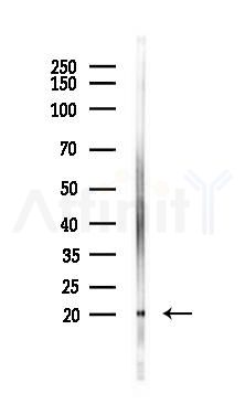 UBE2C Recombinant Rabbit mAb - Western blot analysis of lysates from PC12 cells(UV 30min treatment), using UBE2C Recombinant Rabbit mAb at 1/1000 dilution.