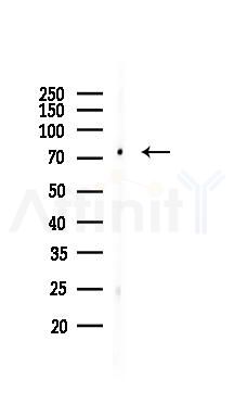 MeCP2 Recombinant Rabbit mAb - Western blot analysis of lysates from Hela cells(UV 30min treatment), using MeCP2 Recombinant Rabbit mAb at 1/1000 dilution.
