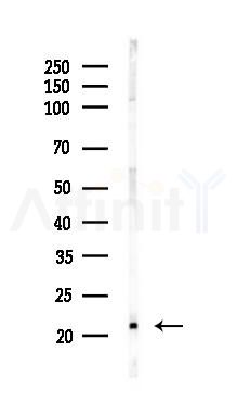 Proteasome 20S LMP2 Recombinant Rabbit mAb - Western blot analysis of lysates from Mouse heart, using Proteasome 20S LMP2 Recombinant Rabbit mAb at 1/1000 dilution.
