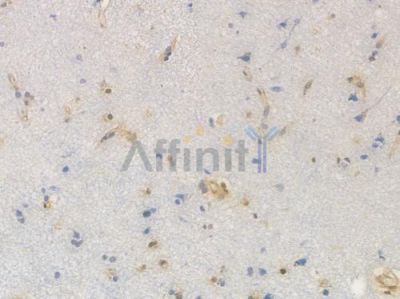 Proteasome 20S LMP2 Recombinant Rabbit mAb - BF4606 at 1/100 staining Human brain tissue by IHC-P.