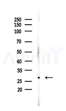 GSTP1 Recombinant Rabbit mAb - Western blot analysis of lysates from HUVEC cells(UV 30min treatment), using GSTP1 Recombinant Rabbit mAb at 1/1000 dilution.