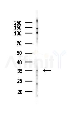CCR6 Recombinant Rabbit mAb - Western blot analysis of lysates from Rat heart, using CCR6 Recombinant Rabbit mAb at 1/1000 dilution.