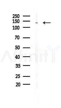 HDAC4 Recombinant Rabbit mAb - Western blot analysis of lysates from HUVEC cells(UV 30min treatment), using HDAC4 Recombinant Rabbit mAb at 1/1000 dilution.