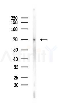 Acid sphingomyelinase Recombinant Rabbit mAb - Western blot analysis of lysates from PC12 cells(UV 30min treatment), using Acid sphingomyelinase Recombinant Rabbit mAb at 1/1000 dilution.
