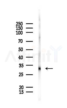 Connexin 32 Recombinant Rabbit mAb - Western blot analysis of lysates from Rat testis, using Connexin 32 Recombinant Rabbit mAb at 1/1000 dilution.