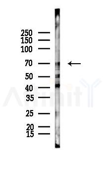 FGL1 Recombinant Rabbit mAb - Western blot analysis of lysates from Rat heart, using FGL1 Recombinant Rabbit mAb at 1/1000 dilution.