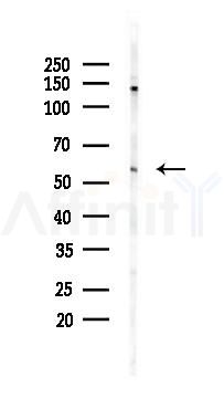 PDIA3 Recombinant Rabbit mAb - Western blot analysis of lysates from HUVEC cells(UV 30min treatment), using PDIA3 Recombinant Rabbit mAb at 1/1000 dilution.