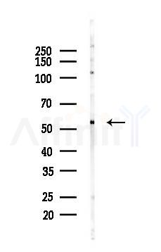 GPR30 Recombinant Rabbit mAb - Western blot analysis of lysates from PC12 cells(UV 30min treatment), using GPR30 Recombinant Rabbit mAb at 1/1000 dilution.