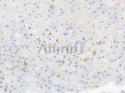 CD244 Recombinant Rabbit mAb - BF4624 at 1/100 staining Human liver tissue by IHC-P.