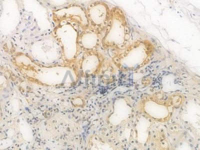 ALDOA Recombinant Rabbit mAb - BF4627 at 1/100 staining Human renal tissue by IHC-P.