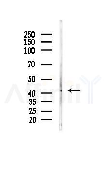 DNMT3L Recombinant Rabbit mAb - Western blot analysis of lysates from K562 cells(UV 30min treatment), using DNMT3L Recombinant Rabbit mAb at 1/1000 dilution.