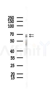 ATG16L1 Recombinant Rabbit mAb - Western blot analysis of lysates from 293 cells(starvation 24h treatment), using ATG16L1 Recombinant Rabbit mAb at 1/1000 dilution.