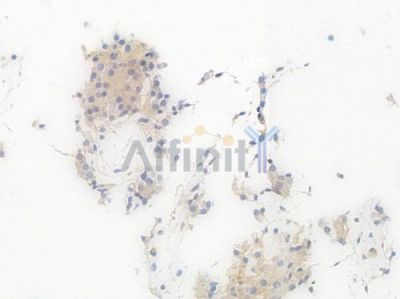 ATG16L1 Recombinant Rabbit mAb - BF4629 at 1/100 staining Human testicular tissue by IHC-P.