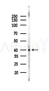 VEGFD Recombinant Rabbit mAb - Western blot analysis of lysates from HUVEC cells(starvation 24h treatment), using VEGFD Recombinant Rabbit mAb at 1/1000 dilution.