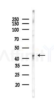 TIA1 Recombinant Rabbit mAb - Western blot analysis of lysates from HUVEC cells(starvation 24h treatment), using TIA1 Recombinant Rabbit mAb at 1/1000 dilution.