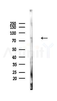 NLRP3 Mouse monoclonal Antibody - Western blot analysis of lysates from Rat muscle, using NLRP3 Mouse monoclonal Antibody at 1/1000 dilution.