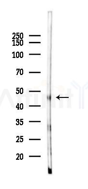 ABHD3 Mouse Monoclonal Antibody - Western blot analysis of lysates from K562 cells(UV 30min treatment), using ABHD3 Mouse Monoclonal Antibody at 1/1000 dilution.