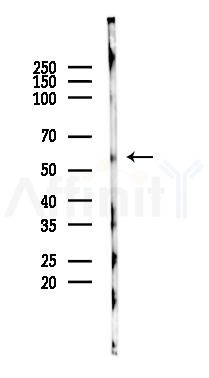 SLC18A2 Mouse Monoclonal Antibody - Western blot analysis of lysates from HUVEC cells(UV 30min treatment), using SLC18A2 Mouse Monoclonal Antibody at 1/1000 dilution.