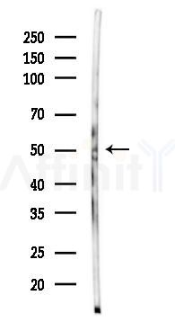 Src Mouse Monoclonal Antibody - Western blot analysis of lysates from Mouse lung, using Src Mouse Monoclonal Antibody at 1/1000 dilution.