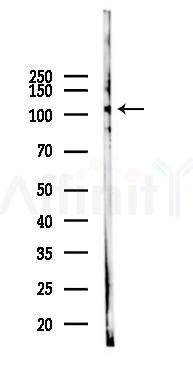 EPHA1 Mouse Monoclonal Antibody - Western blot analysis of lysates from K562 cells(UV 30min treatment), using EPHA1 Mouse Monoclonal Antibody at 1/1000 dilution.