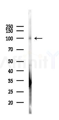 EZH2 Mouse Monoclonal Antibody - Western blot analysis of lysates from K562 cells(UV 30min treatment), using EZH2 Mouse Monoclonal Antibody at 1/1000 dilution.