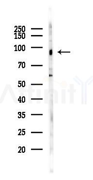 STAT1 Mouse Monoclonal Antibody - Western blot analysis of lysates from K562 cells(UV 30min treatment), using STAT1 Mouse Monoclonal Antibody at 1/1000 dilution.
