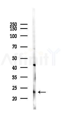 DDIT3/CHOP Mouse Monoclonal Antibody - Western blot analysis of lysates from K562 cells(UV 30min treatment), using DDIT3/CHOP Mouse Monoclonal Antibody at 1/1000 dilution.