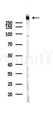 DNA-PK Mouse Monoclonal Antibody - Western blot analysis of lysates from K562 cells(UV 30min treatment), using DNA-PK Mouse Monoclonal Antibody at 1/1000 dilution.