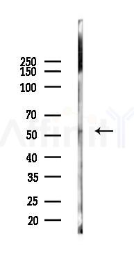 TGFBR1 Mouse Monoclonal Antibody - Western blot analysis of lysates from K562 cells(LPS 4h treatment), using TGFBR1 Mouse Monoclonal Antibody at 1/1000 dilution.