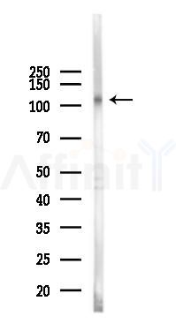 Flt3/CD135 Mouse Monoclonal Antibody - Western blot analysis of lysates from K562 cells(UV 30min treatment), using Flt3/CD135 Mouse Monoclonal Antibody at 1/1000 dilution.