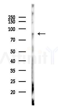 eIF2B epsilon Mouse Monoclonal Antibody - Western blot analysis of lysates from K562 cells(UV 30min treatment), using eIF2B epsilon Mouse Monoclonal Antibody at 1/1000 dilution.