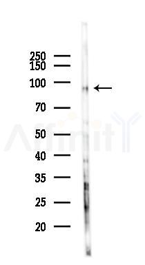 CD22 Mouse Monoclonal Antibody - Western blot analysis of lysates from K562 cells(UV 30min treatment), using CD22 Mouse Monoclonal Antibody at 1/1000 dilution.