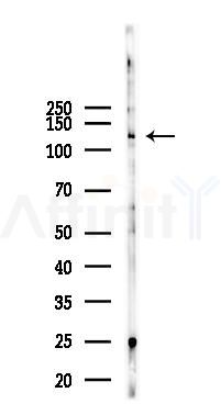 PDGF Receptor alpha Mouse Monoclonal Antibody - Western blot analysis of lysates from K562 cells(UV 30min treatment), using PDGF Receptor alpha Mouse Monoclonal Antibody at 1/1000 dilution.
